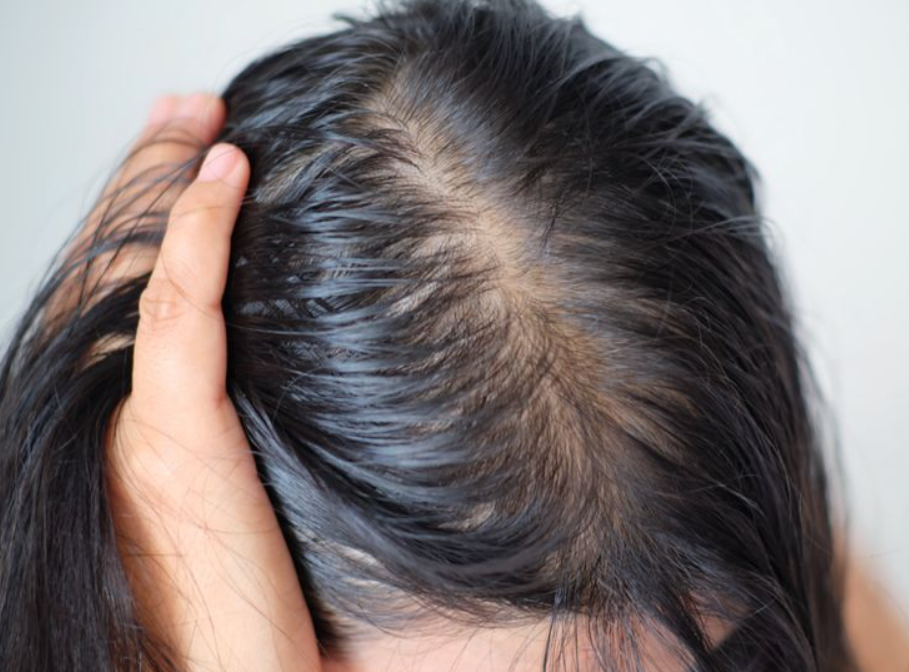 Hair Fall & Hair Loss Treatment